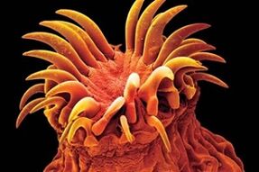 Paraziti trematoda u lidí