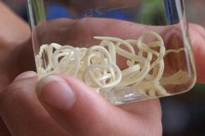 parazity z lidského těla